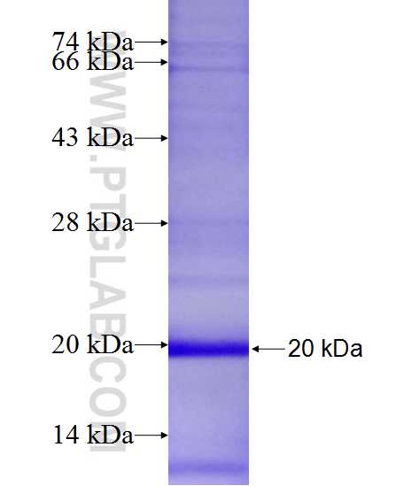 SLCO5A1 fusion protein Ag22620 SDS-PAGE