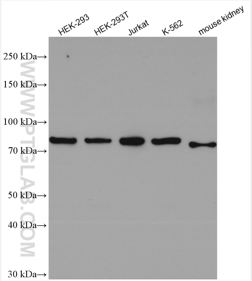 Western Blot (WB) analysis of various lysates using SLCO6A1 Polyclonal antibody (11078-1-AP)
