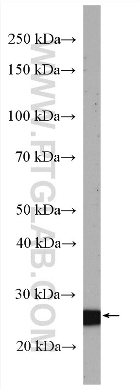 WB analysis of mouse thymus using 13315-1-AP