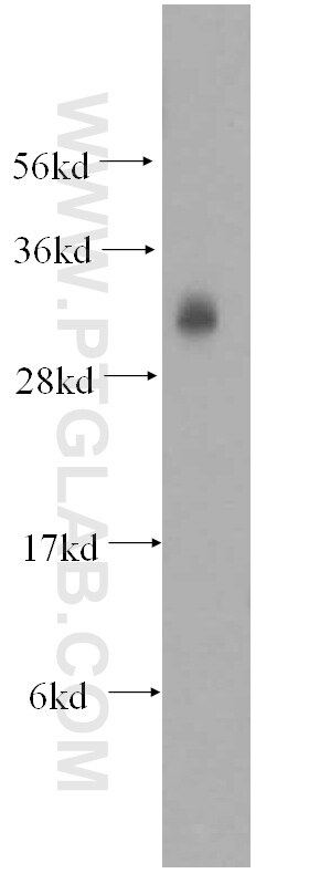 WB analysis of mouse testis using 13315-1-AP