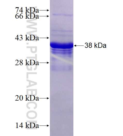 SLD5 fusion protein Ag4158 SDS-PAGE