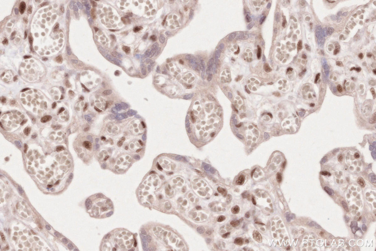 IHC staining of human placenta using 26060-1-AP Immunohistochemistry (IHC) staining of human placenta tissue using SLFN11 Polyclonal antibody (26060-1-AP)