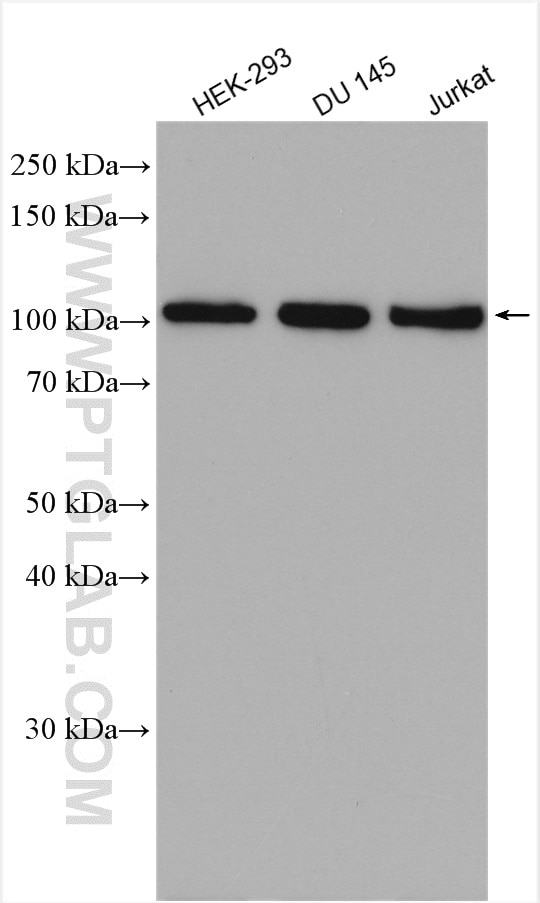 Western Blot (WB) analysis of various lysates using SLFN11 Polyclonal antibody (26060-1-AP)