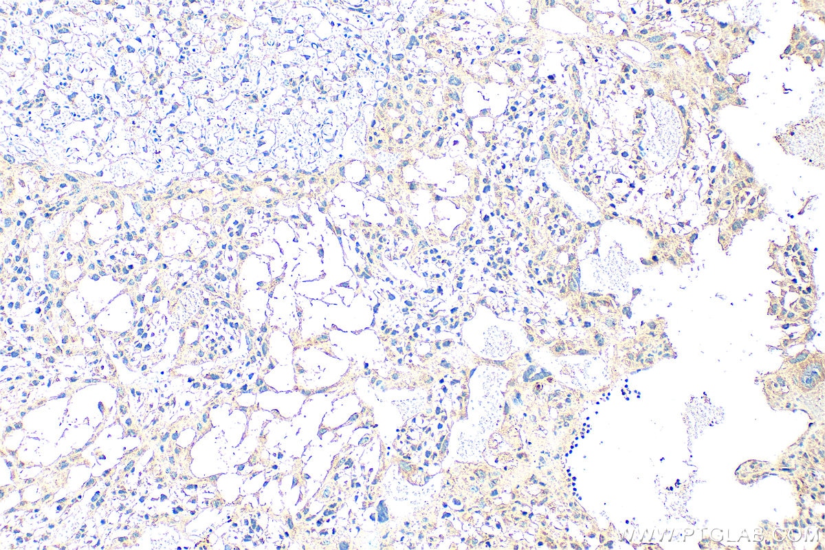IHC staining of mouse placenta using 30550-1-AP Immunohistochemistry (IHC) staining of mouse placenta tissue using SLFN12 Polyclonal antibody (30550-1-AP)