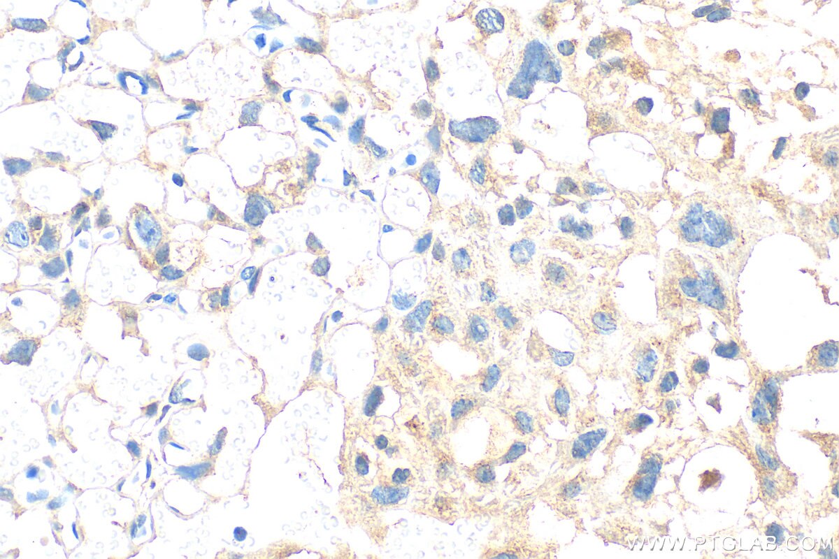 IHC staining of mouse placenta using 30550-1-AP Immunohistochemistry (IHC) staining of mouse placenta tissue using SLFN12 Polyclonal antibody (30550-1-AP)