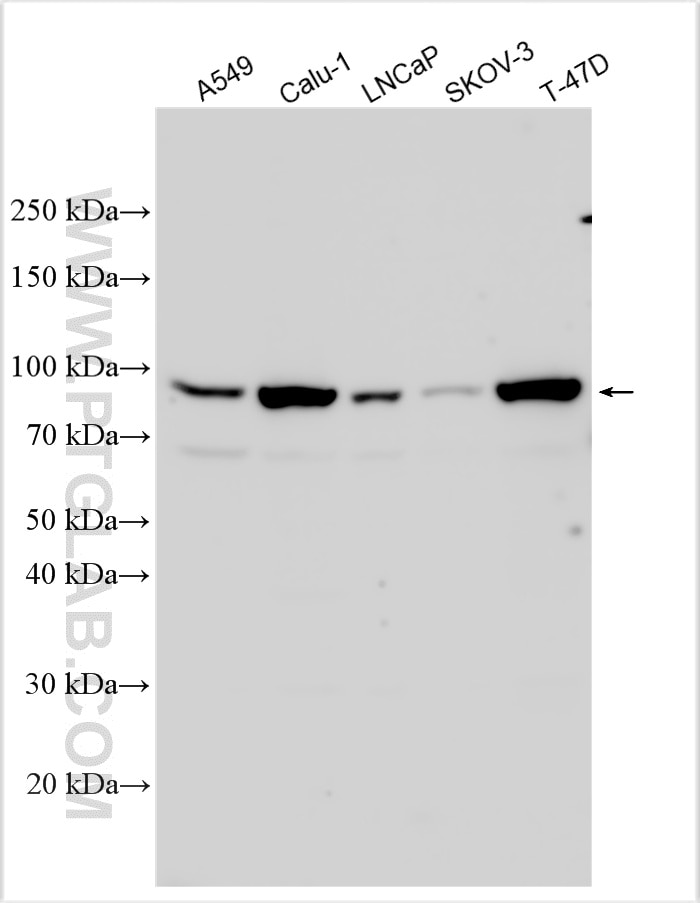 Western Blot (WB) analysis of various lysates using SLFN5 Polyclonal antibody (16581-1-AP)