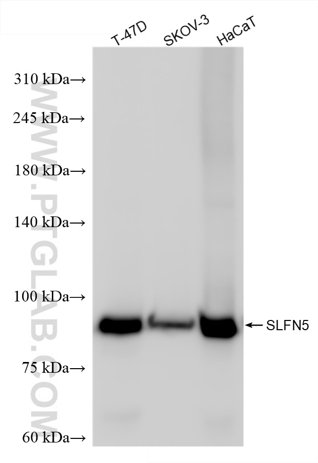 Western Blot (WB) analysis of various lysates using SLFN5 Recombinant antibody (86424-1-RR)