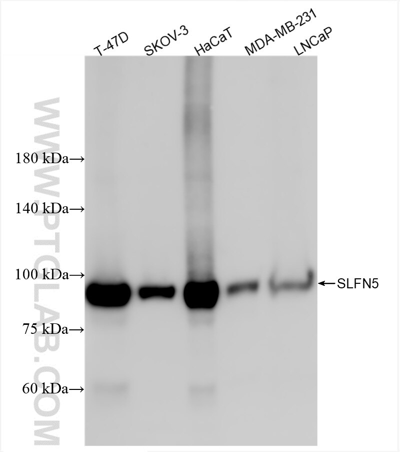 Western Blot (WB) analysis of various lysates using SLFN5 Recombinant antibody (86424-2-RR)