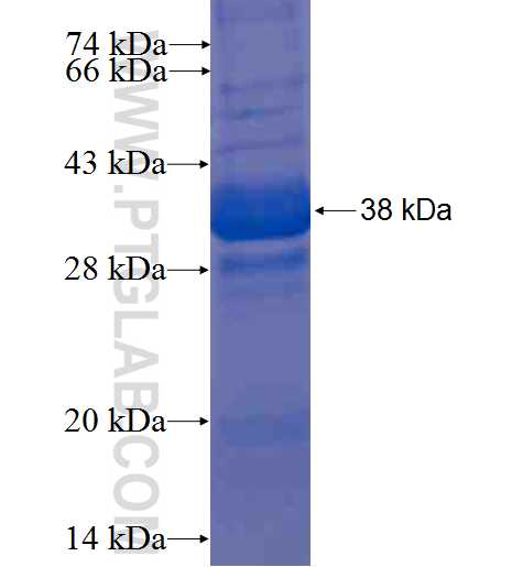 SLFN5 fusion protein Ag9168 SDS-PAGE SLFN5 fusion protein Ag9168 SDS-PAGE