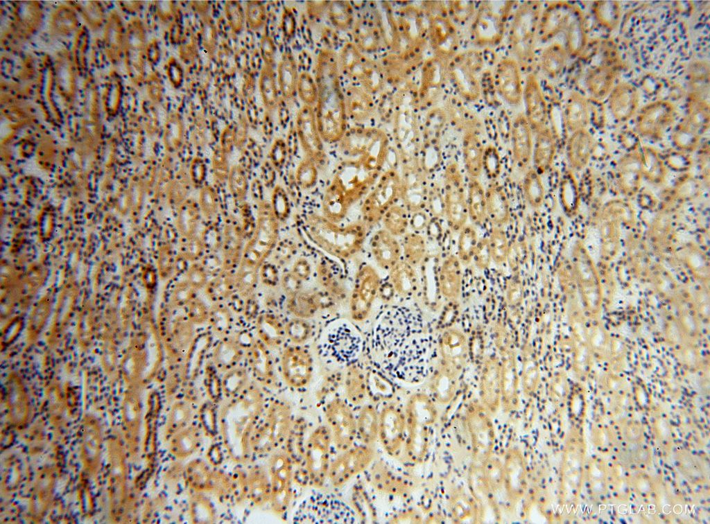 Immunohistochemistry (IHC) staining of human kidney tissue using SLFNL1 Polyclonal antibody (17065-1-AP)