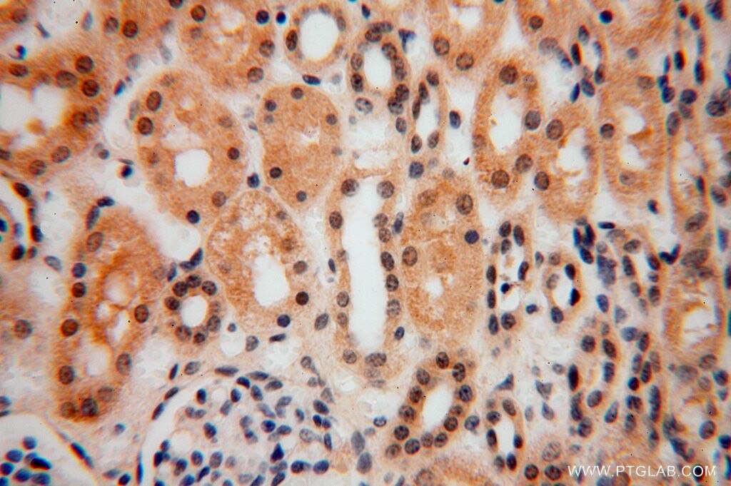 Immunohistochemistry (IHC) staining of human kidney tissue using SLFNL1 Polyclonal antibody (17065-1-AP)