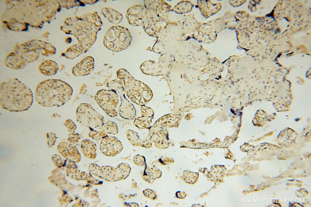 Immunohistochemistry (IHC) staining of human placenta tissue using SLFNL1 Polyclonal antibody (17065-1-AP)