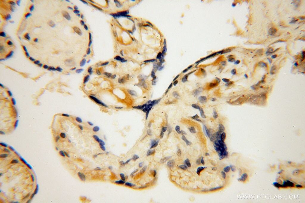 Immunohistochemistry (IHC) staining of human placenta tissue using SLFNL1 Polyclonal antibody (17065-1-AP)