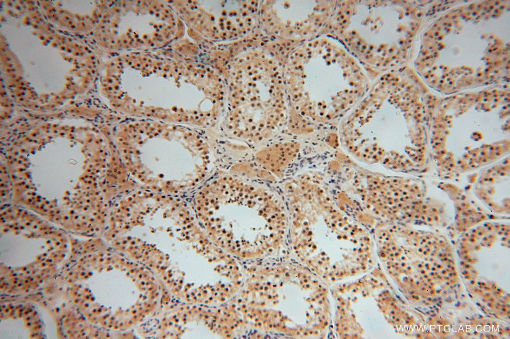 IHC staining of human testis using 17065-1-AP