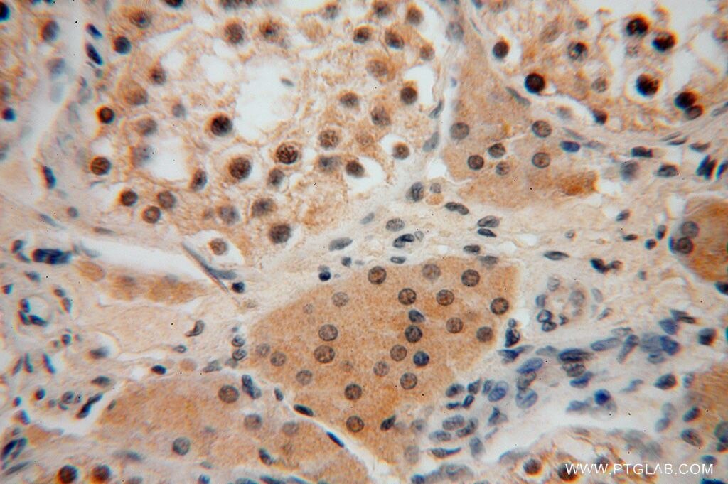 Immunohistochemistry (IHC) staining of human testis tissue using SLFNL1 Polyclonal antibody (17065-1-AP)
