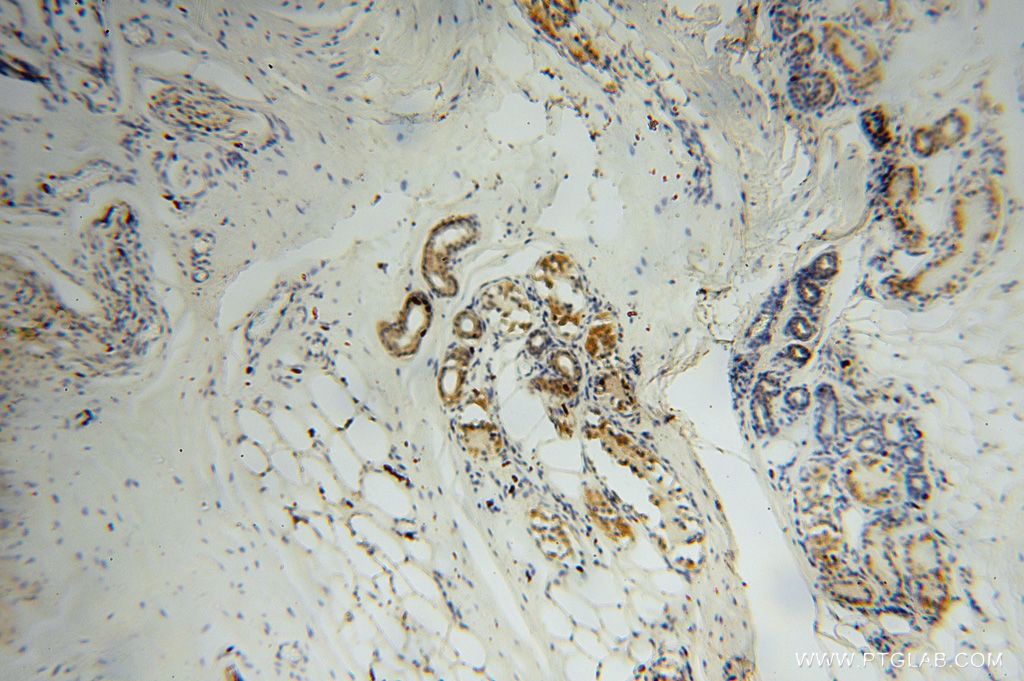 Immunohistochemistry (IHC) staining of human skin tissue using SLFNL1 Polyclonal antibody (17065-1-AP)