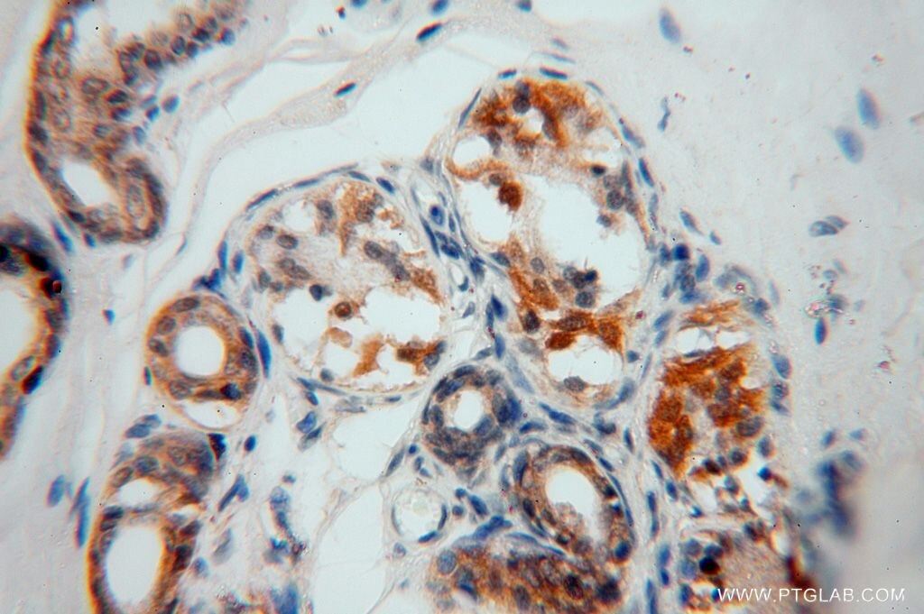 Immunohistochemistry (IHC) staining of human skin tissue using SLFNL1 Polyclonal antibody (17065-1-AP)