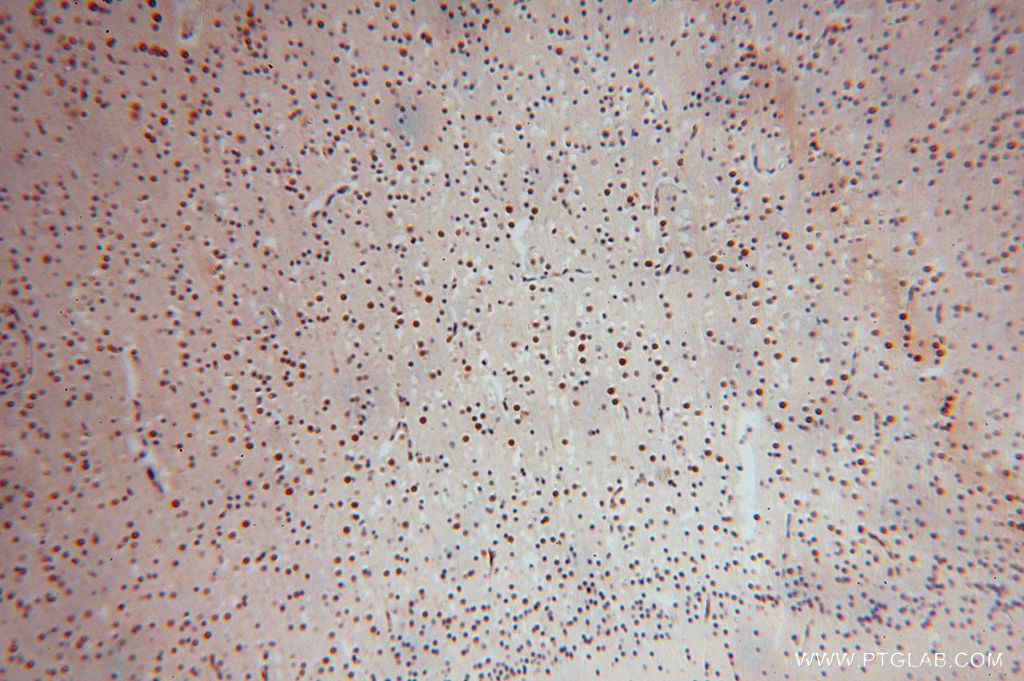 Immunohistochemistry (IHC) staining of human brain tissue using SLFNL1 Polyclonal antibody (17065-1-AP)