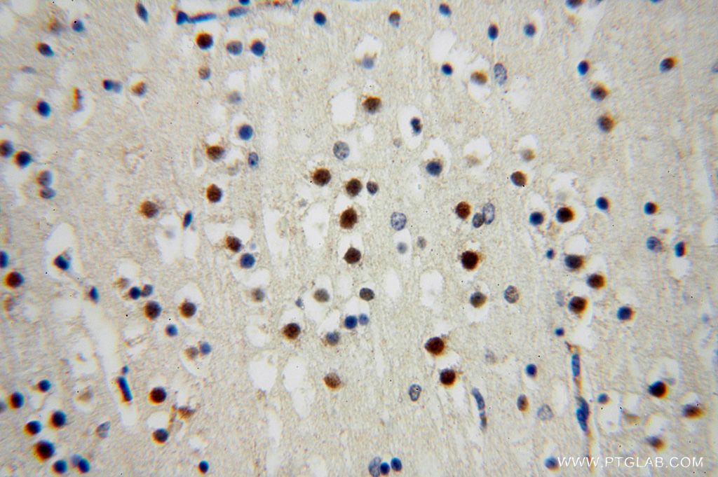 IHC staining of human brain using 17065-1-AP
