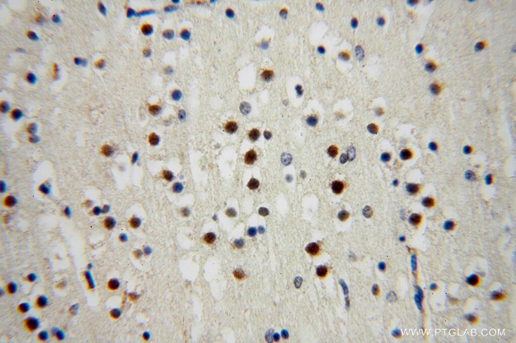 Immunohistochemistry (IHC) staining of human brain tissue using SLFNL1 Polyclonal antibody (17065-1-AP)