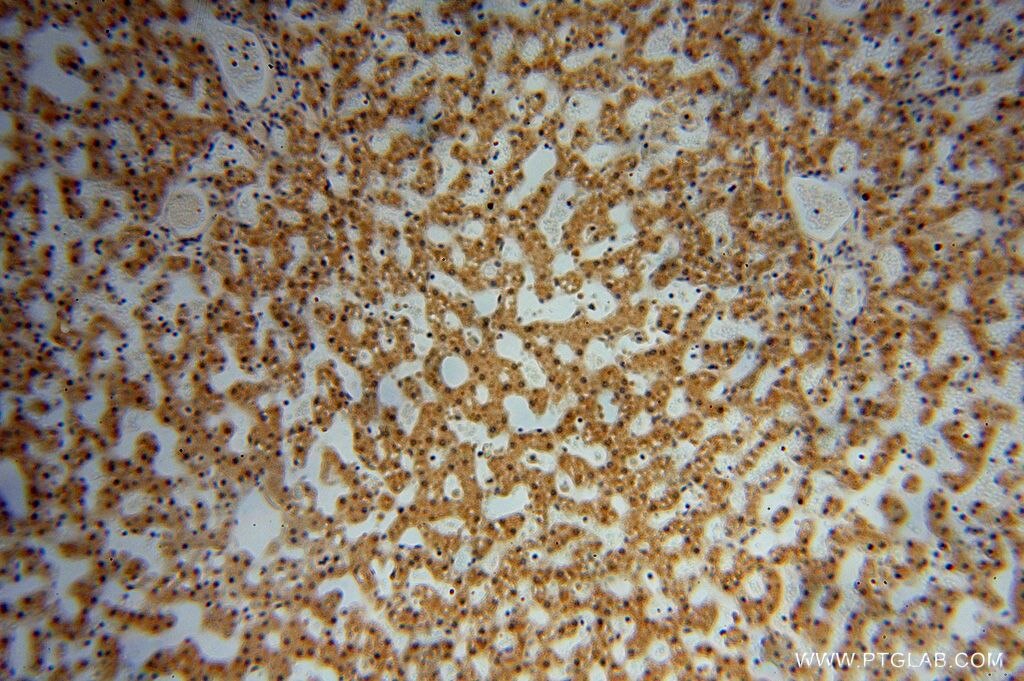 Immunohistochemistry (IHC) staining of human liver tissue using SLFNL1 Polyclonal antibody (17065-1-AP)