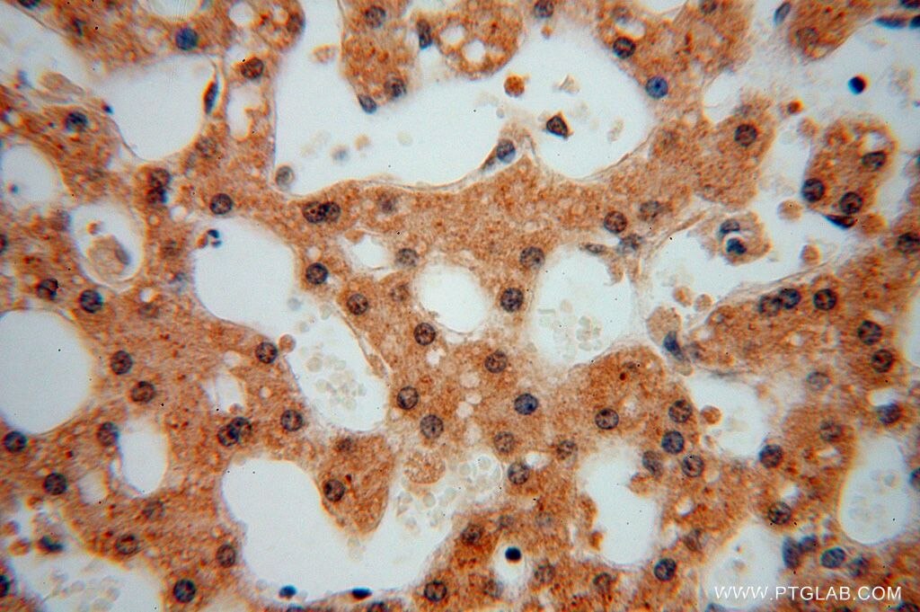 Immunohistochemistry (IHC) staining of human liver tissue using SLFNL1 Polyclonal antibody (17065-1-AP)