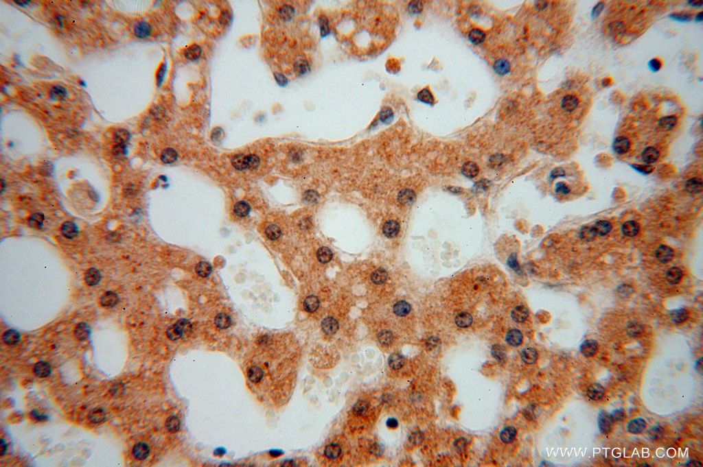 IHC staining of human liver using 17065-1-AP