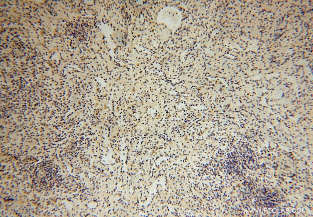 Immunohistochemistry (IHC) staining of human spleen tissue using SLFNL1 Polyclonal antibody (17065-1-AP)