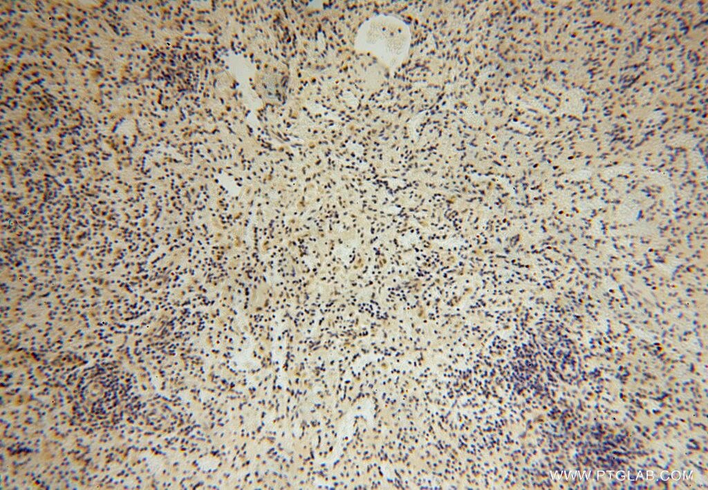 IHC staining of human spleen using 17065-1-AP