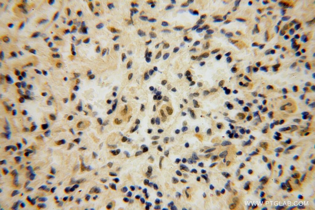 Immunohistochemistry (IHC) staining of human spleen tissue using SLFNL1 Polyclonal antibody (17065-1-AP)