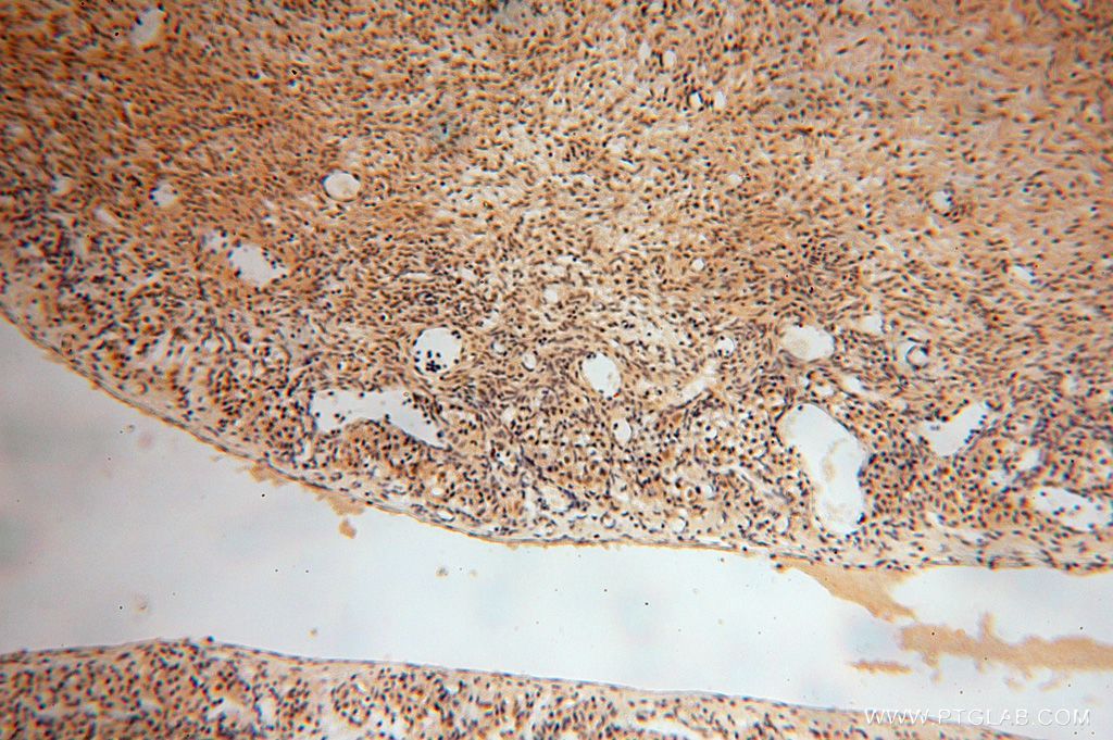 Immunohistochemistry (IHC) staining of human ovary tissue using SLFNL1 Polyclonal antibody (17065-1-AP)