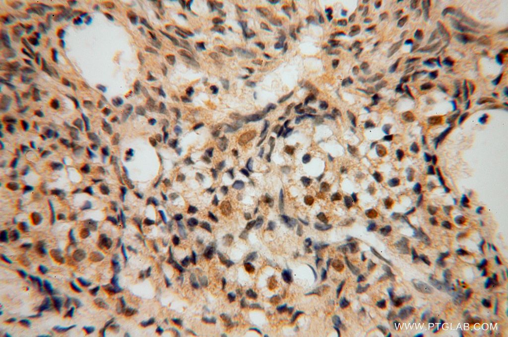 Immunohistochemistry (IHC) staining of human ovary tissue using SLFNL1 Polyclonal antibody (17065-1-AP)