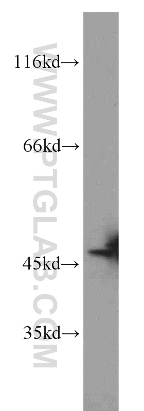 Western Blot (WB) analysis of COLO 320 cells using SLFNL1 Polyclonal antibody (17065-1-AP)