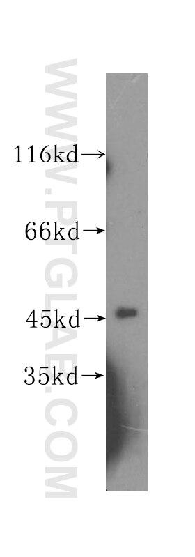 Western Blot (WB) analysis of COLO 320 cells using SLFNL1 Polyclonal antibody (17065-1-AP)