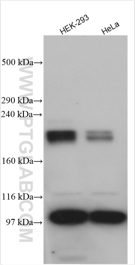Western Blot (WB) analysis of various lysates using SLIT2 Polyclonal antibody (28730-1-AP)