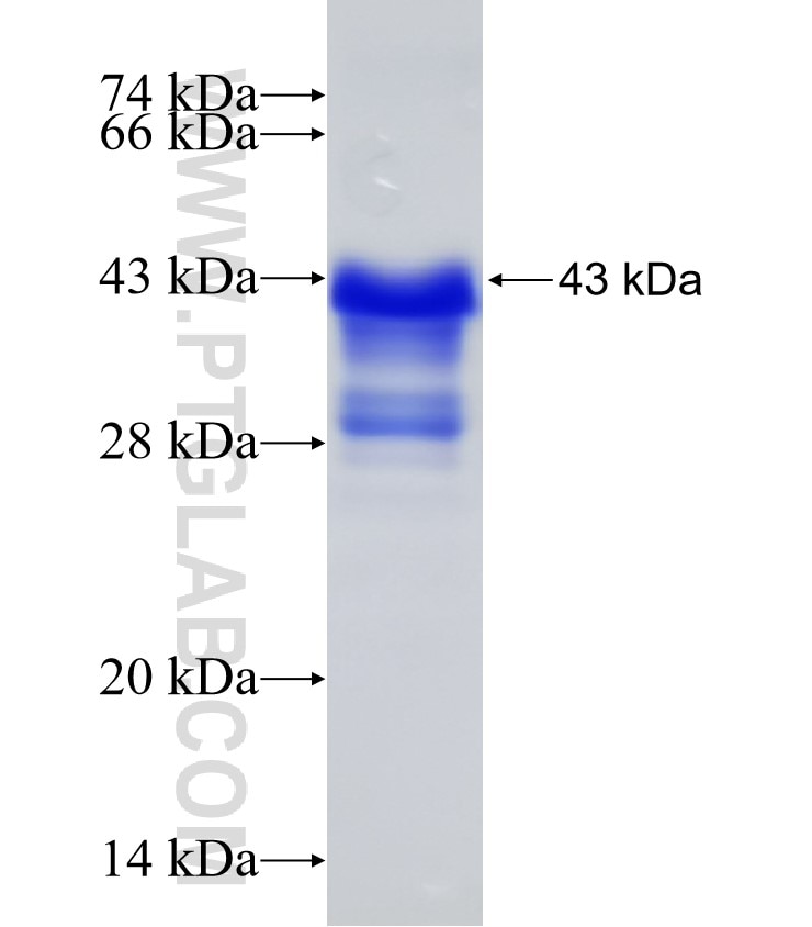 SLIT2 fusion protein Ag30428 SDS-PAGE