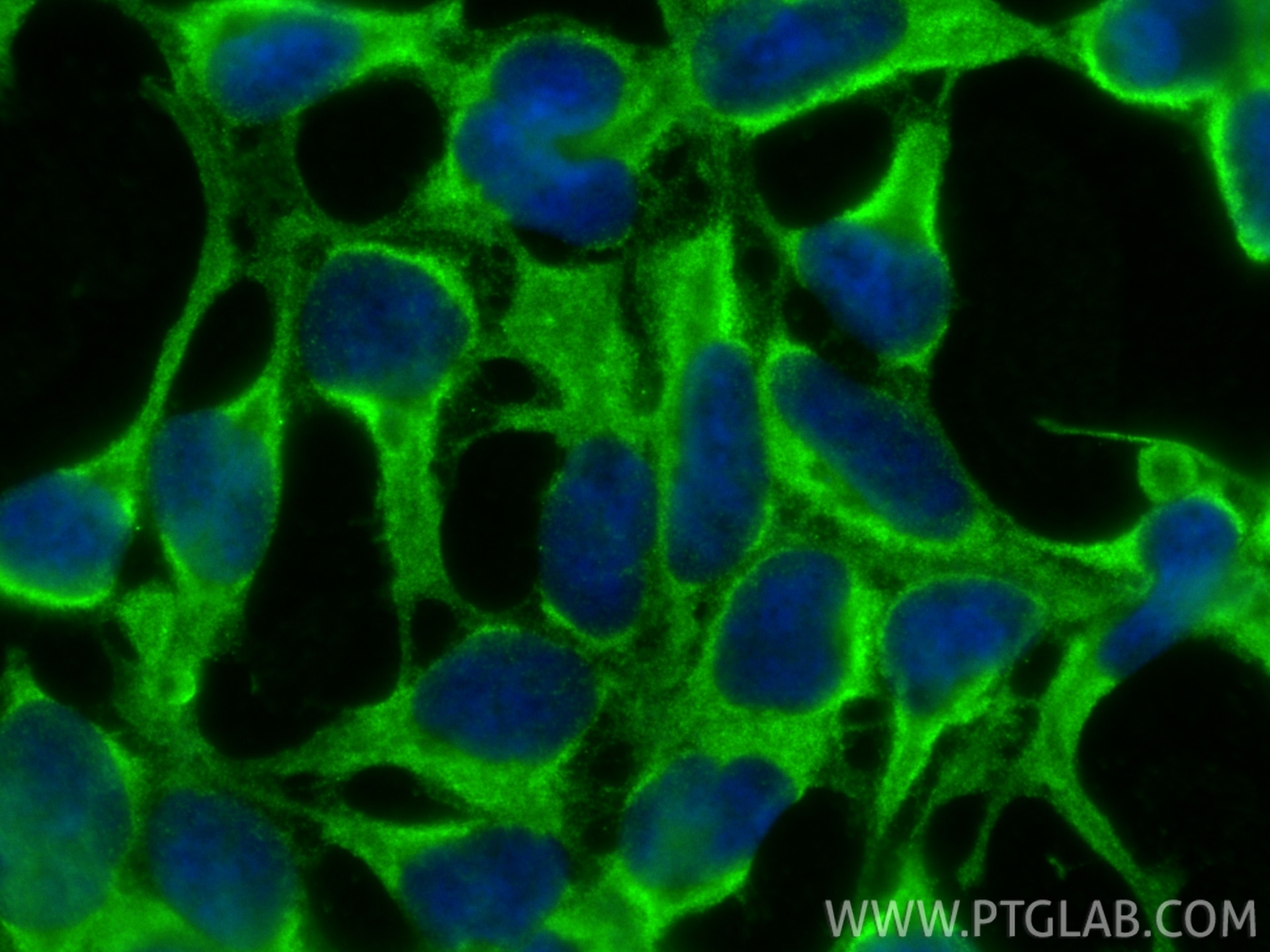 Immunofluorescent analysis of (-20°C Ethanol) fixed HEK-293 cells using SLIT2-Specific antibody (20217-1-AP) at dilution of 1:400 and CoraLite®488-Conjugated Goat Anti-Rabbit IgG(H+L) (SA00013-2). Immunofluorescence (IF) / fluorescent staining of HEK-293 cells using SLIT2-Specific Polyclonal antibody (20217-1-AP)
