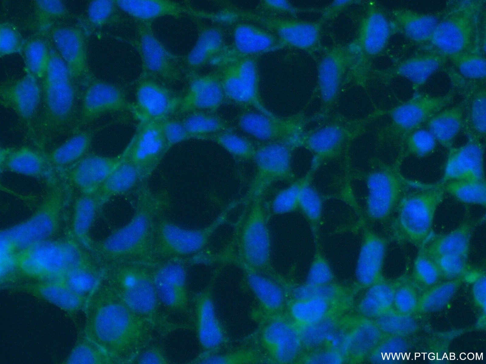 Immunofluorescence (IF) / fluorescent staining of HEK-293 cells using SLIT2-Specific Polyclonal antibody (20217-1-AP)