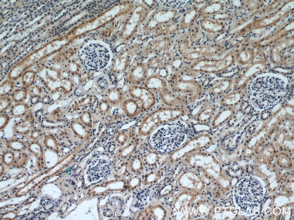 Immunohistochemistry (IHC) staining of human kidney tissue using SLIT2-Specific Polyclonal antibody (20217-1-AP)