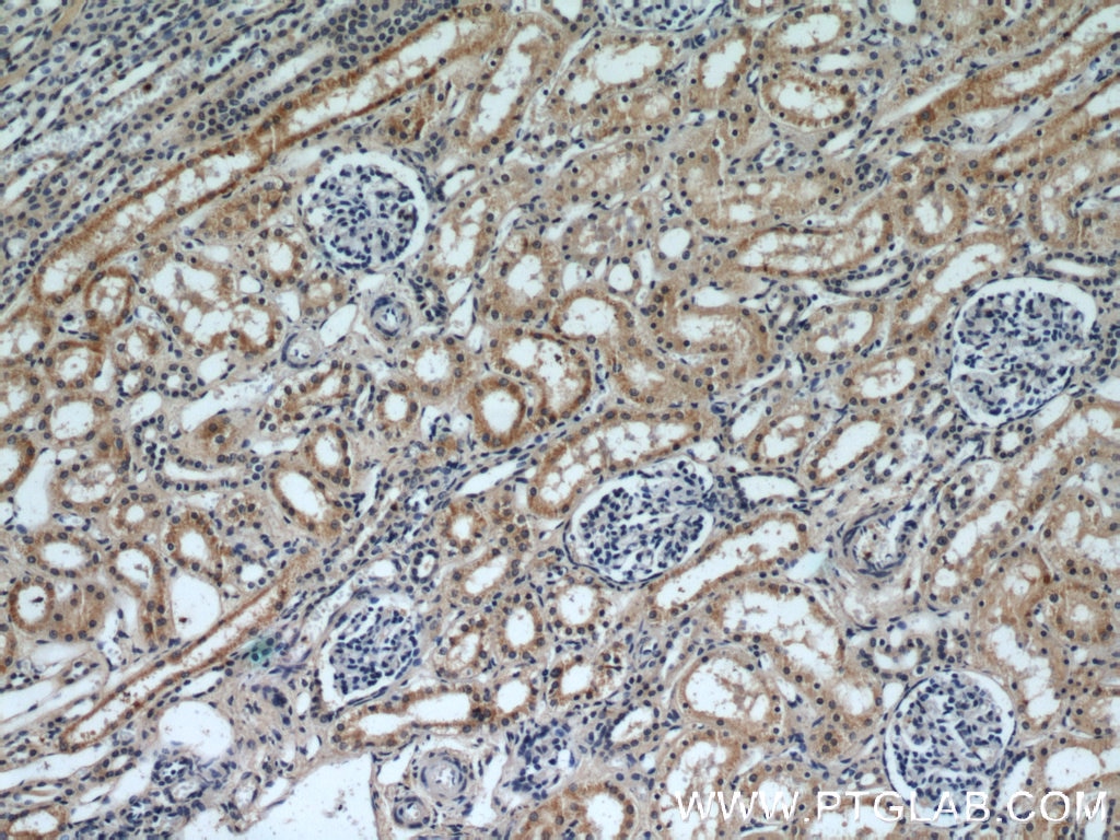 IHC staining of human kidney using 20217-1-AP