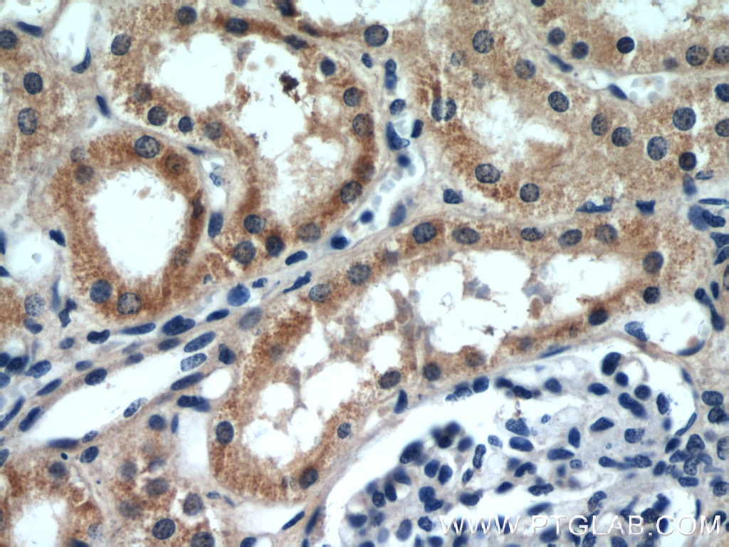 Immunohistochemistry (IHC) staining of human kidney tissue using SLIT2-Specific Polyclonal antibody (20217-1-AP)