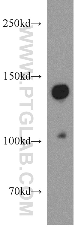 Western Blot (WB) analysis of mouse brain tissue using SLIT2-Specific Polyclonal antibody (20217-1-AP)