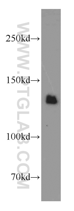 Western Blot (WB) analysis of mouse brain tissue using SLIT2-Specific Polyclonal antibody (20217-1-AP)