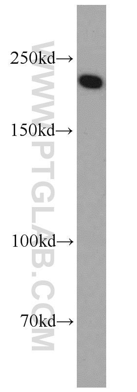 Western Blot (WB) analysis of HEK-293 cells using SLIT2-Specific Polyclonal antibody (20217-1-AP)