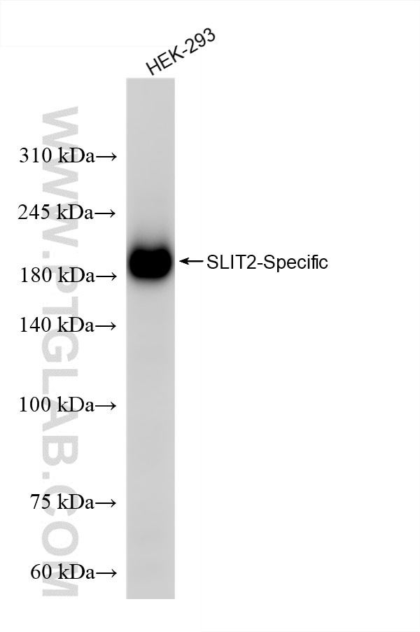 Western Blot (WB) analysis of HEK-293 cells using SLIT2-Specific Recombinant antibody (82725-4-RR)