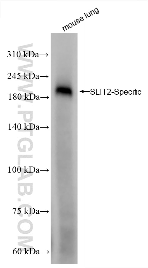 SLIT2-Specific
