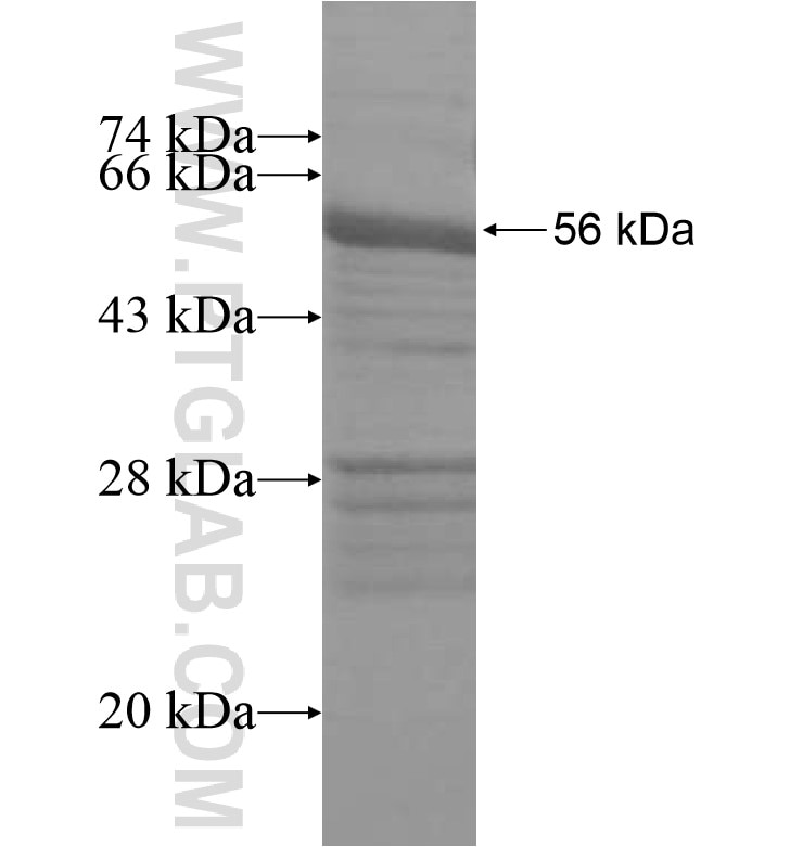 SLIT3 fusion protein Ag16258 SDS-PAGE