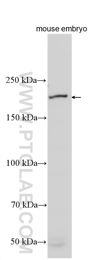 Western Blot (WB) analysis of various lysates using SLIT3-Specific Polyclonal antibody (20218-1-AP)