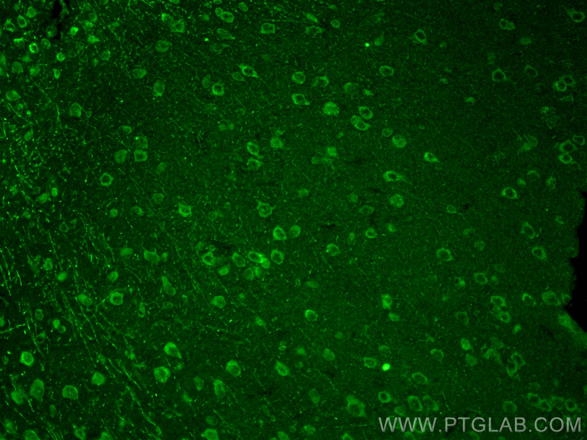 Immunofluorescence (IF) / fluorescent staining of mouse brain tissue using SLITRK1 Polyclonal antibody (21119-1-AP)