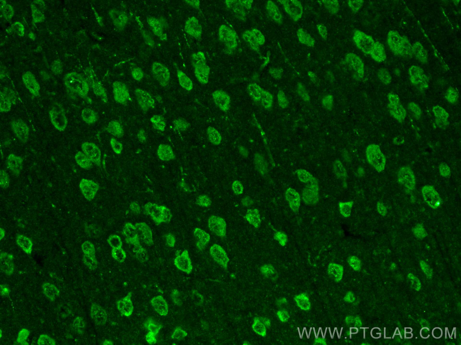 Immunofluorescence (IF) / fluorescent staining of mouse brain tissue using SLITRK1 Polyclonal antibody (21119-1-AP)